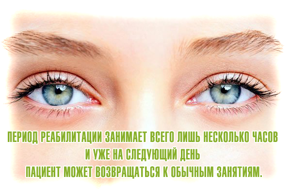 Лазерная коррекция зрения в Израиле: диагностика
