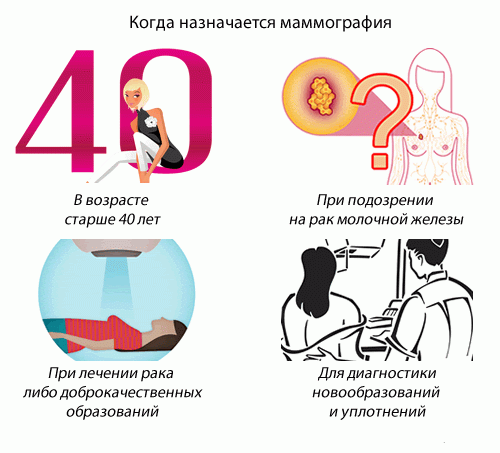Когда назначается маммография