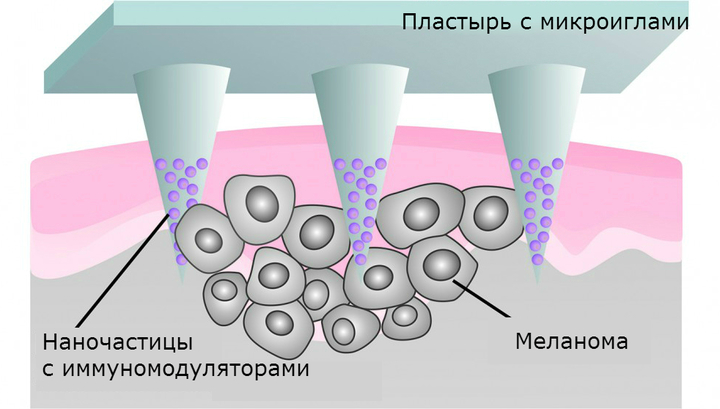 Пластырь