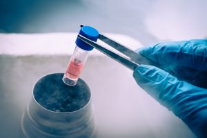Использование стволовых клеток 