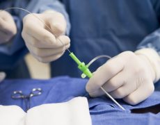 Что собой представляет криотерапия метастаз и опухолей печени