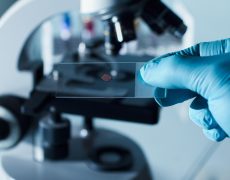 Лечение лейкоза посредством биодатчика